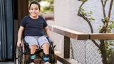 Muscular Dystrophy Treatment in Ayurveda – Natural Healing Approaches