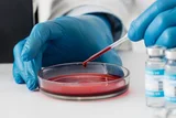 How to Reduce Eosinophil Count in Ayurveda – Natural Remedies & Lifestyle Adjustments