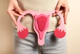 Endometriosis and Ayurveda Insights