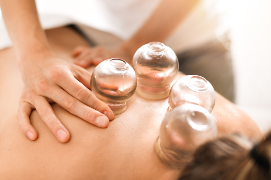 Benefits of Cupping Therapy - Everything You Need To Know!